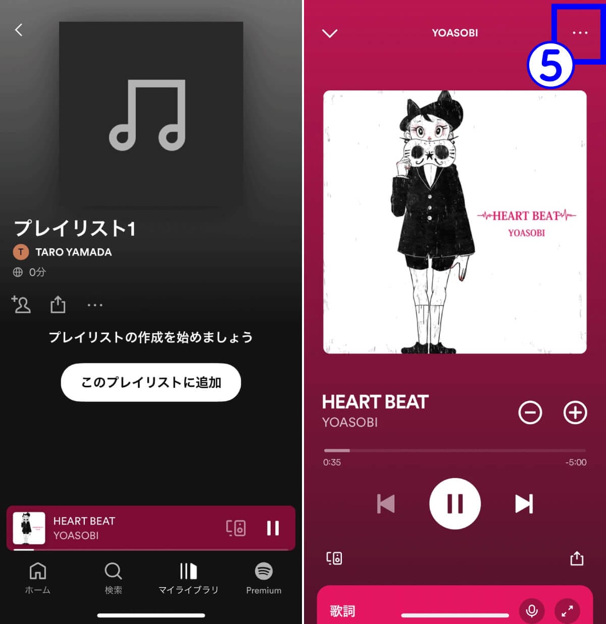 Spotifyの仕様は「意味が分からない」?再生中に違う曲が流れるなど諸問題への対処法の画像5